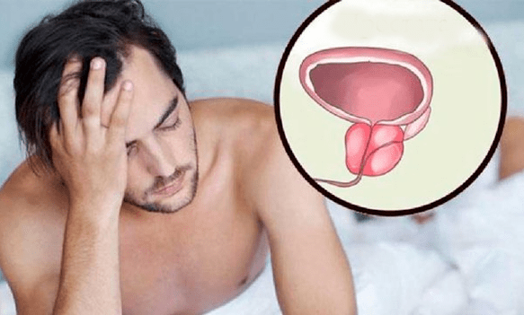 Příznaky prostatitidy